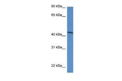 DDO Rabbit anti-Human, Polyclonal, Novus Biologicals:Antibodies:Primary